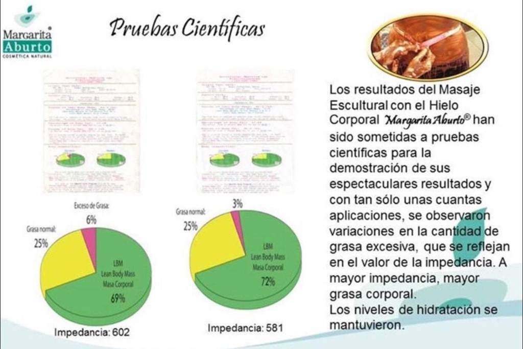 Hieloterapia Margarita Aburto