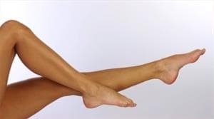 Prevenir las varices